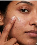 Lucènci Acne Defence Serum